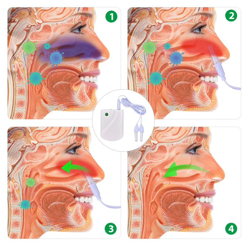 Dispositivo Terapêutico para Tratamento Nasal